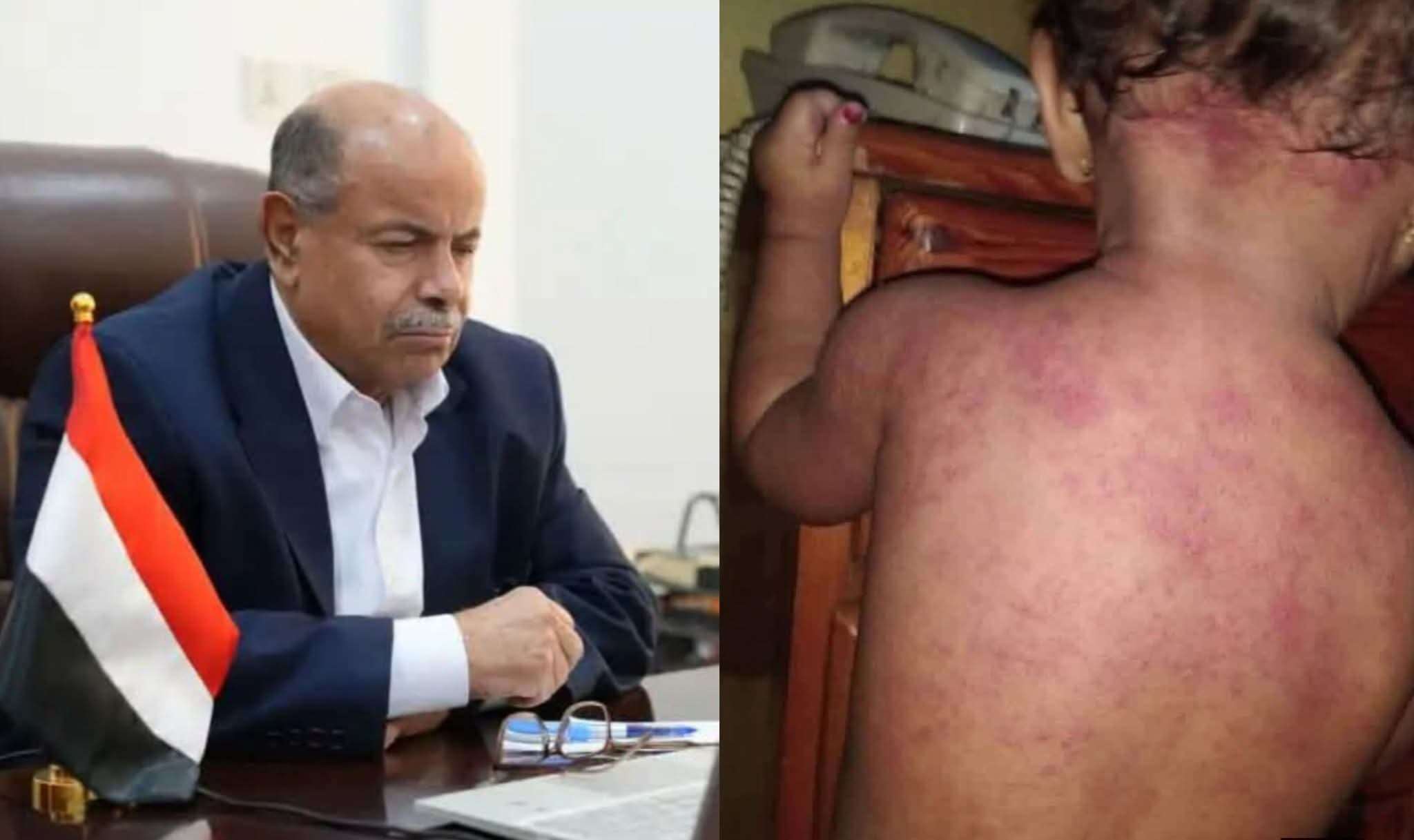 الكشف عن المسؤول البارز المتهم بخنق عدن بأزمة الكهرباء